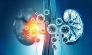 Thận 'kêu cứu' theo 5 giai đoạn thế nào Thận 'kêu cứu' theo 5 giai đoạn thế nào