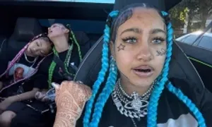 Nha sĩ cảnh báo mốt răng đen kiểu 'con gái Kim Kardashian'